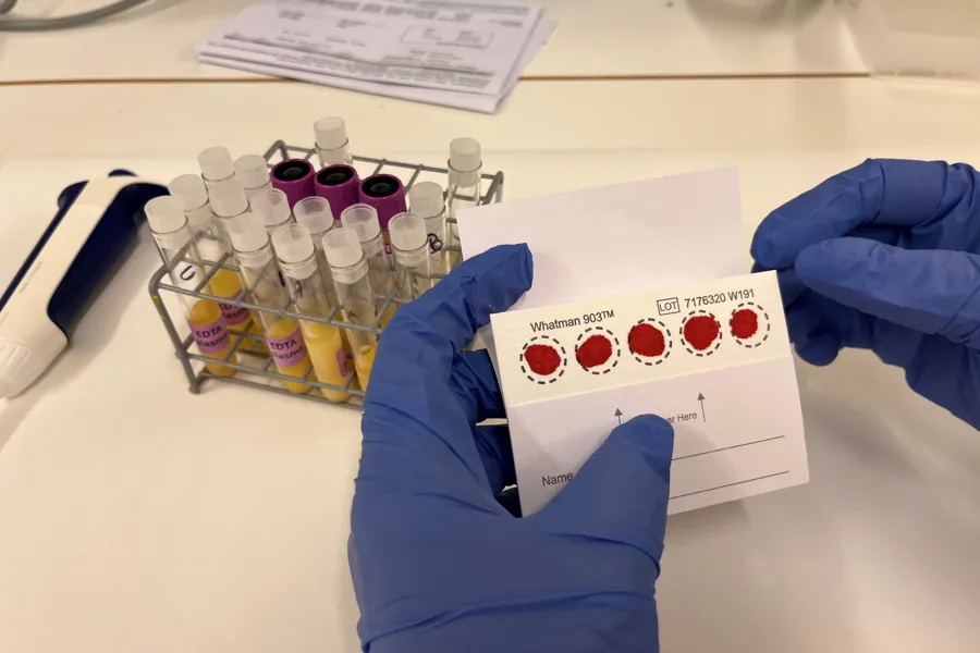 Bloddråpeark til bruk ved metabolomikk